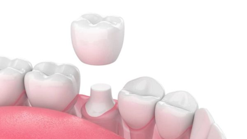 boc-rang-su-co-dau-khong-1