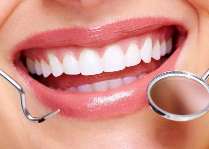 Những lưu ý khi bọc răng sứ lần 2