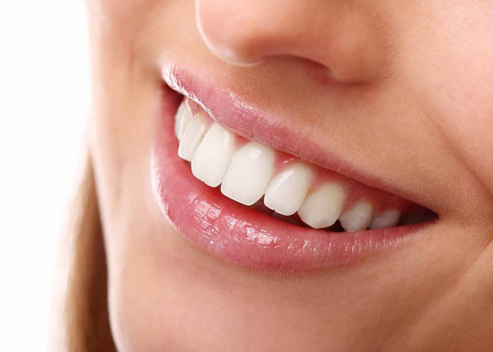 Thời gian bọc răng sứ mất bao lâu thì hoàn thiện