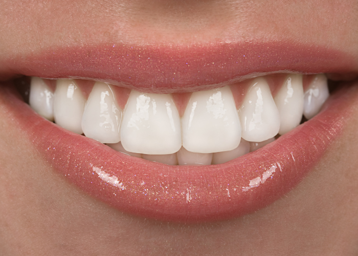 Tư vấn: Bọc răng sứ nguyên hàm giá bao nhiêu?