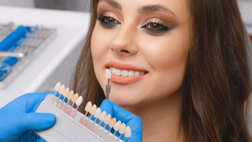 chi-phi-boc-rang-su-rang-cua-3