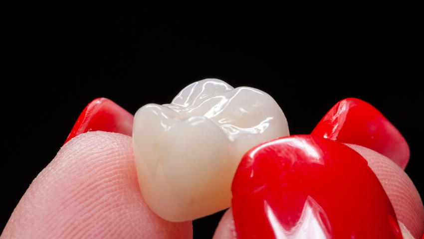 nen-boc-rang-su-loai-nao-1