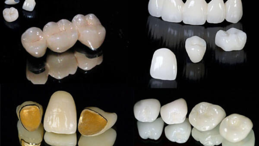 nen-boc-rang-su-loai-nao-2