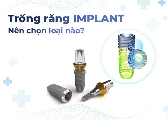 Nên trồng răng Implant loại nào? Tiêu chí chọn trụ Implant