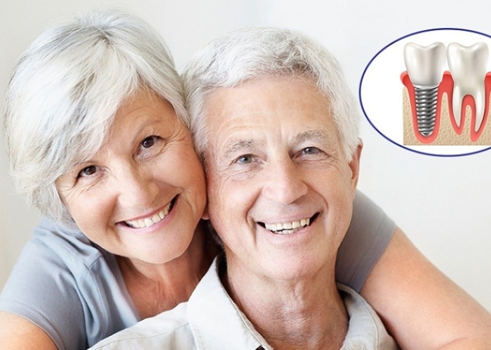 Trồng răng Implant cho người già và những lưu ý
