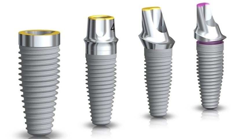 trong-rang-implant-co-ben-khong-2