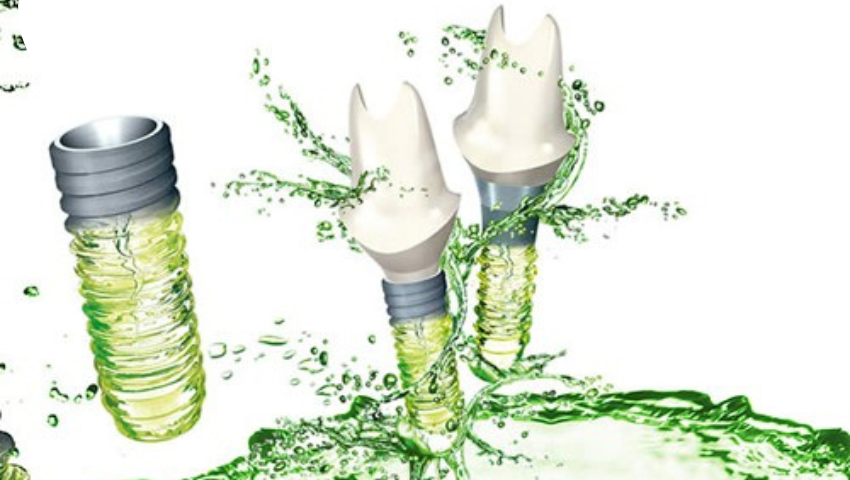 trong-rang-implant-co-may-loai-3