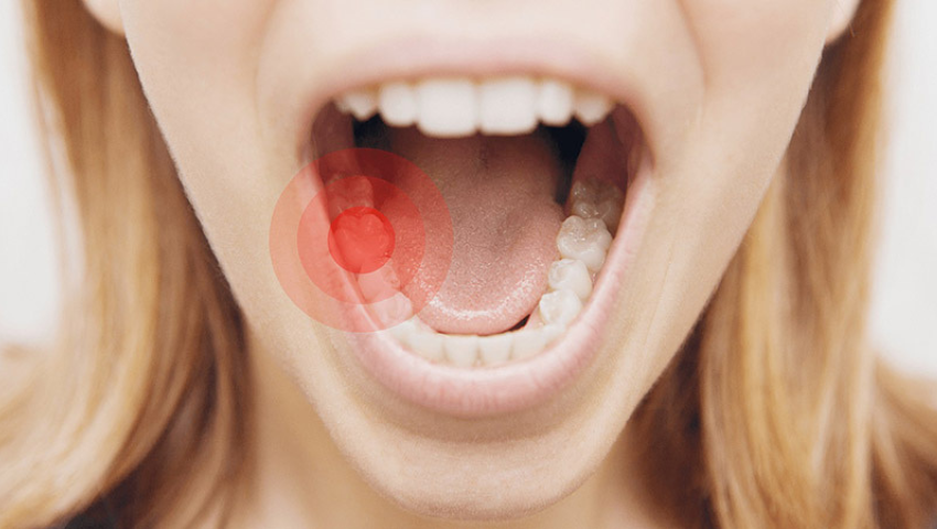 trong-rang-implant-gia-re-2
