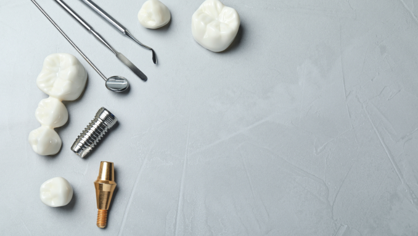 trong-rang-implant-uy-tin-2