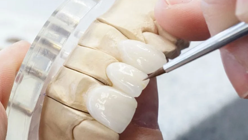 boc-rang-su-bi-tut-loi-2