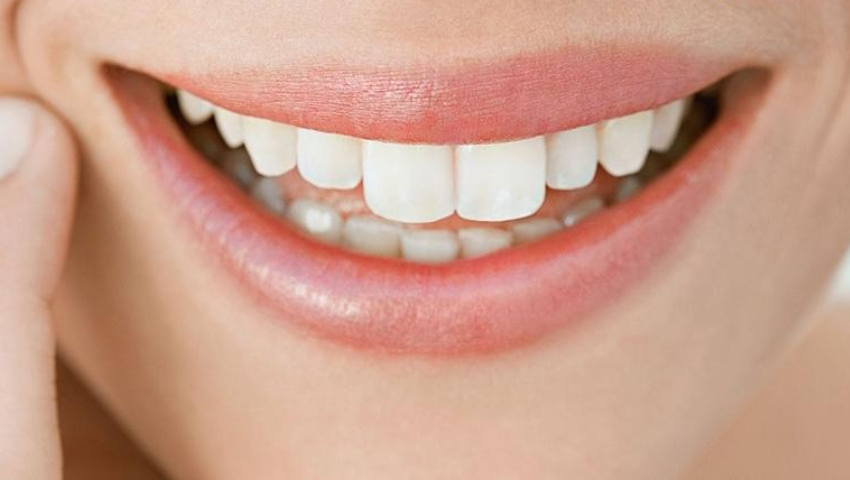 boc-rang-su-kieu-rang-tho-2