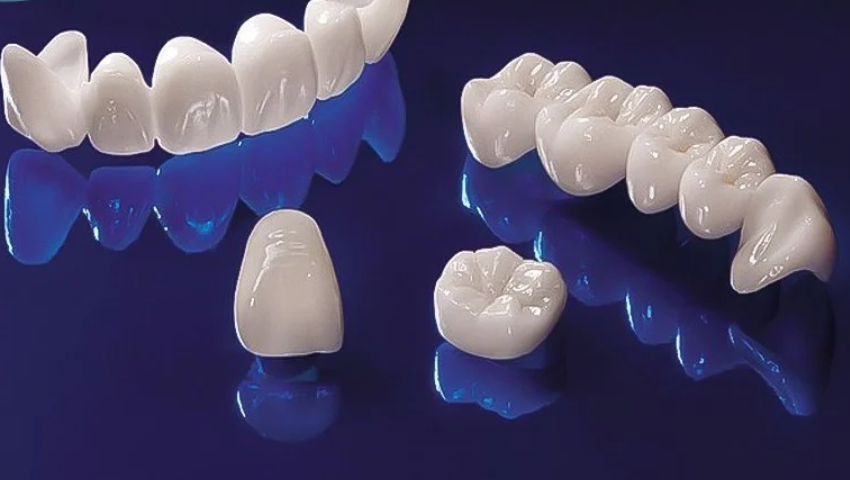 boc-rang-su-nano-5s-2