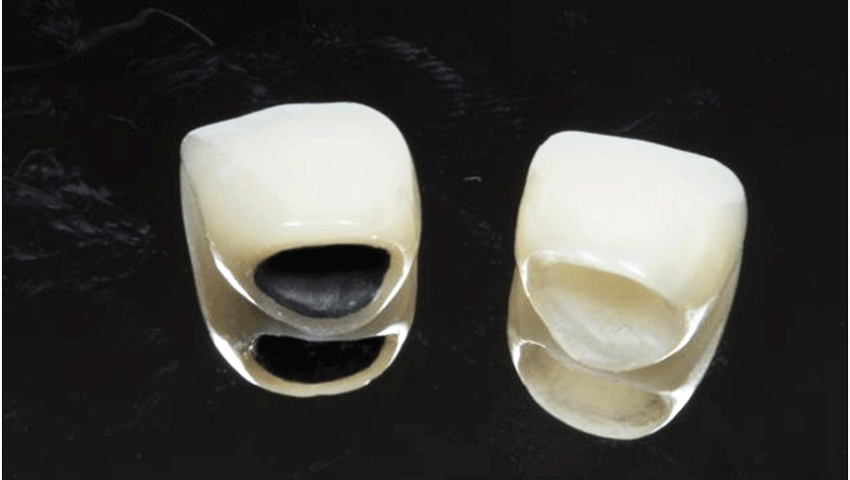 boc-su-rang-cua-bi-lech-3